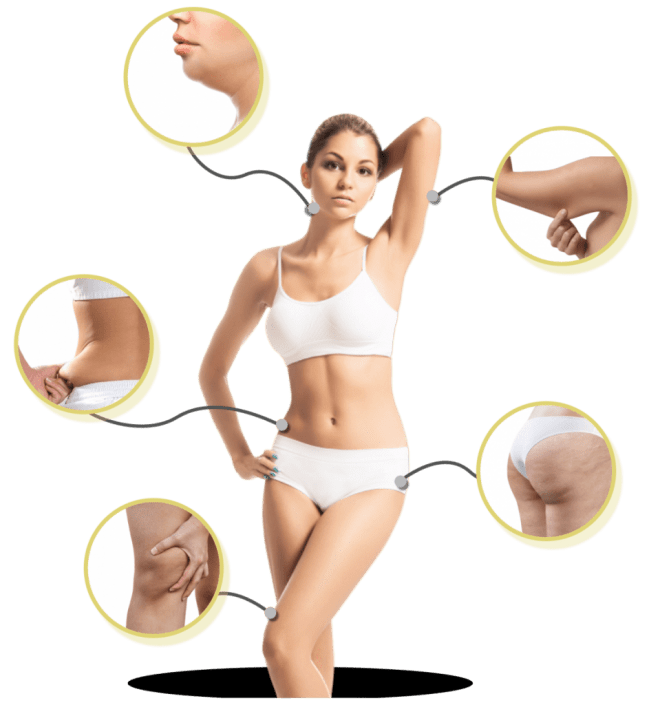 Centre Amincissement Rabat Cryolipolyse Lipocavitation Radiofréquence